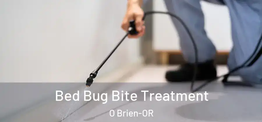  Bed Bug Bite Treatment O Brien-OR